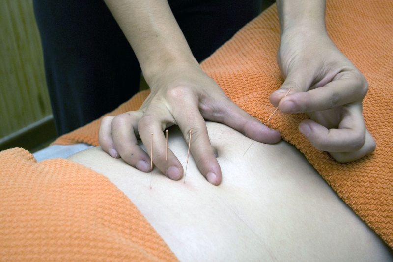 osteopathe-PEGOMAS-min_acupuncture-4175625